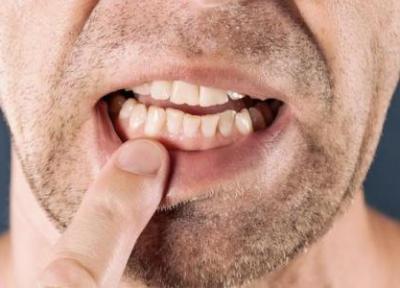 خارش دندان؛ از دلایل تا درمان