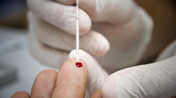 تور هلند: کشف گونه نو و خطرناک ویروس ایدز در هلند